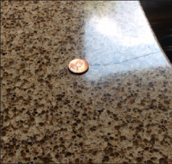 A crack has started in this top using clips to support  an undermount sink. The crack is visible just to the center right of the penny.